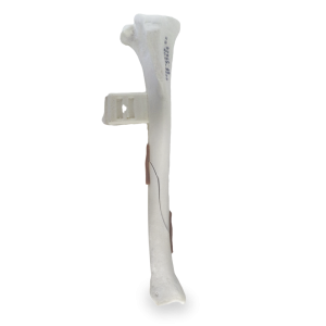 TÍBIA DIREITA ESPONJOSA COM BLOCO E FRATURA OBLIQUA - CÃO GRANDE PORTE - cód. 10492