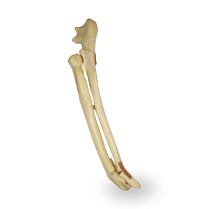 ANTEBRAÇO ESQUERDO COM FRATURA OLECRANO E TRANSVERSA DISTAL - CÃO GRANDE PORTE - cód. AV730EF1